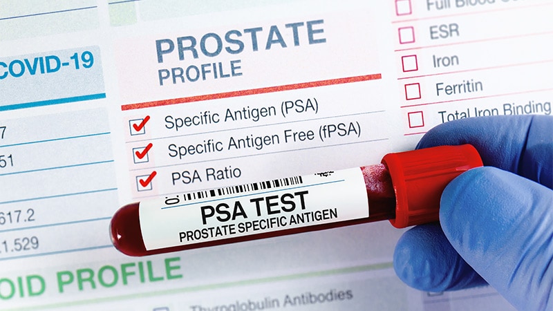 IRONMAN: Can PSA Guide Metastatic Prostate Cancer Care?