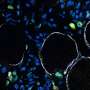 Turning back time on muscle stem cells to prevent frailty due to aging