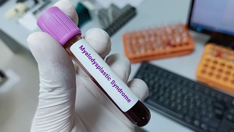 Immune Modulation in MDS: Our Core Strategies Need to Change