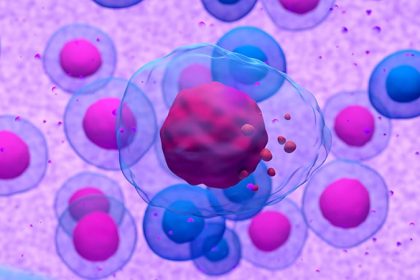 Myeloma: OBI Rivals IV Isatuximab, Ups Patient Comfort