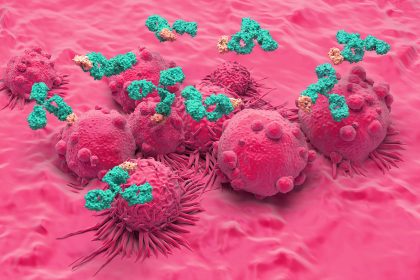 Doublet Shows Activity in Rare, Aggressive Kidney Cancer