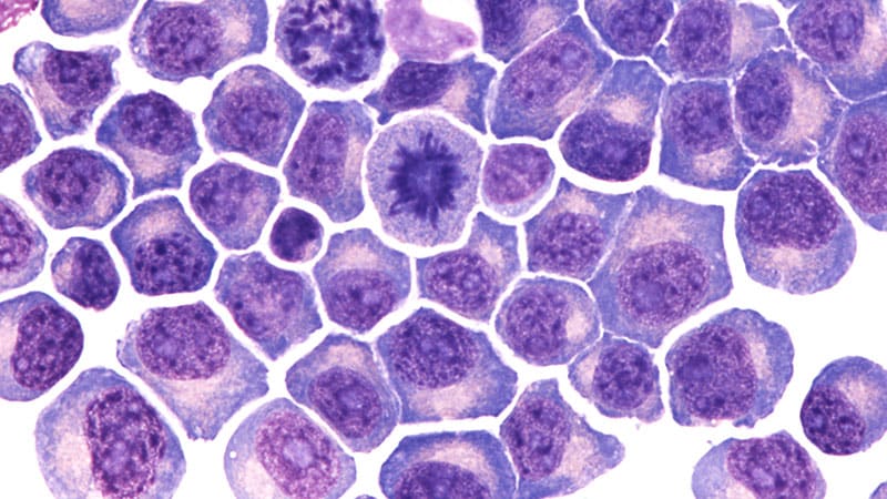 Q&A: New Myeloma Bispecific Rivals CAR T in Early Data