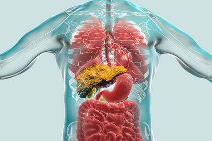 Preemptive TIPS Promising for Fundal Variceal Bleeding