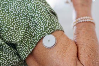 Brief Use of CGM May Enhance Lifestyle Awareness in T2D