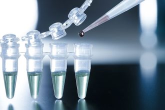 Stem Cell-Derived Islets Still Producing Insulin at 1 Year