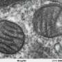Antibiotics and energy inhibitors effectively kill aggressive melanoma cells by blocking mitochondrial pathways