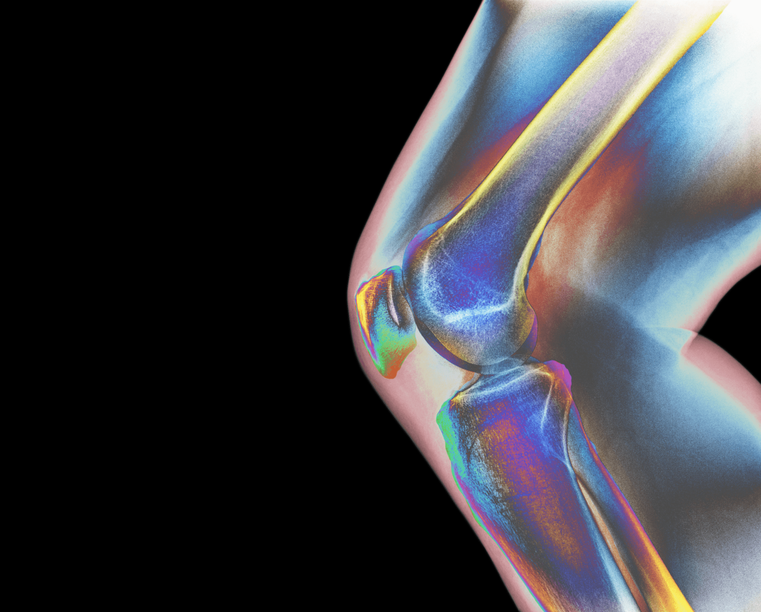 5 Things You Can Do Now to Prevent Osteoporosis in the Future