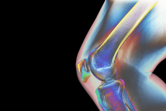 5 Things You Can Do Now to Prevent Osteoporosis in the Future