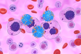 CAR-T for Multiple Myeloma: How to Choose Between Therapies?