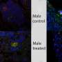 Small molecule treatment could make islet transplantation therapy more effective