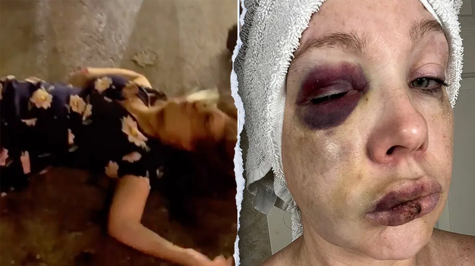 Cincinnati viral beating victim forced into ‘super-secret spot’ with security