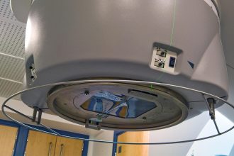 Excess Health Risks Linger in Childhood Cancer Survivors Into 50s and Beyond
