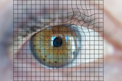 AMD Prevention: Which Strategies Help Keep Eye Disease at Bay?