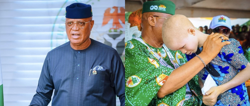 How I Was Mocked For My Albinism During Governorship Campaign – Gov. Umo Eno