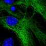 Computational approach meets biology to connect neural progenitor cells with human disorders