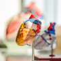 Study compares cardiovascular disease risk in type 1 and 2 diabetes in men and women