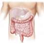 What does an IBD diagnosis mean?