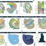 Cell-mapping tool provides insightful multi-layered view of cancer behavior