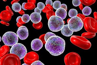 Oral Drug Highly Active in Rare Blood Cancers With FGFR1 Rearrangements