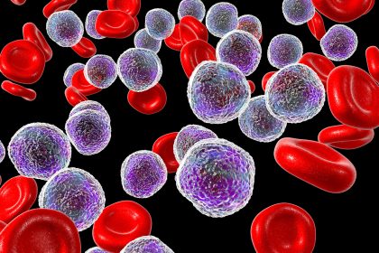 Oral Drug Highly Active in Rare Blood Cancers With FGFR1 Rearrangements