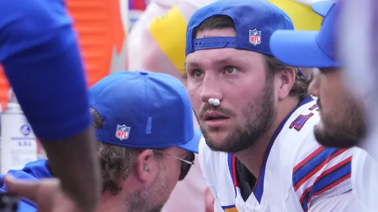 Josh Allen injury update: Latest news on Bills QB’s nose after Monday’s practice