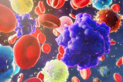 Multicancer Detection Tests Not Ready for Prime Time, Review Suggests