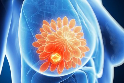 Delayed Breast Cancer Care Raises Mortality Risk