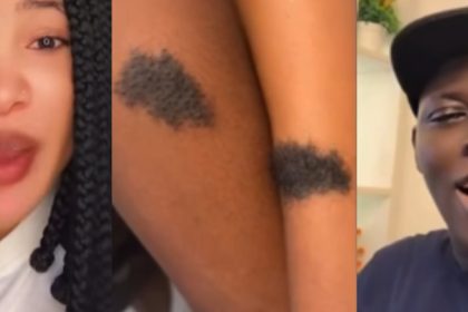 “It’s Like Family Inheritance” – Woman Reacts to Viral Video of Lovers With Matching Birthmark, Advises DNA Test