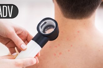 ‘Hit Hard, Hit Early’ Psoriasis Treatment Strategy Gains Momentum