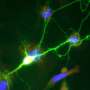 Brain organoids reveal potential neural basis of schizophrenia and bipolar disorder