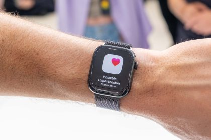 Health Canada approves Apple Watch Hypertension notifications