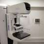 Women who miss their first mammogram face higher risk of breast cancer death, study finds