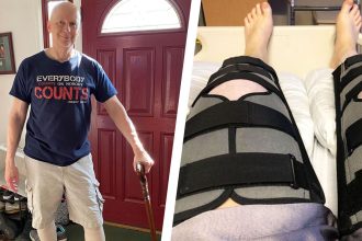 Years of Training Mistakes Caused Me Gruesome Knee Injuries