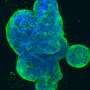 Oral drug combination extends progression-free survival in advanced ER-positive breast cancer