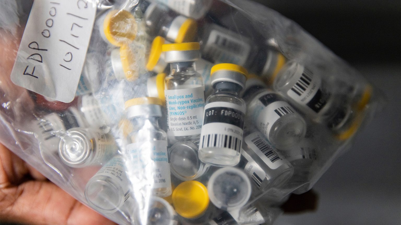 California Mpox Cases Raise Concerns, but Health Officials Say the Risk Remains Low