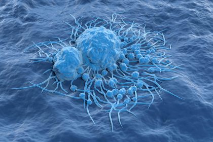 Global Study Reports Rise in Several Cancers Among Adults of All Ages