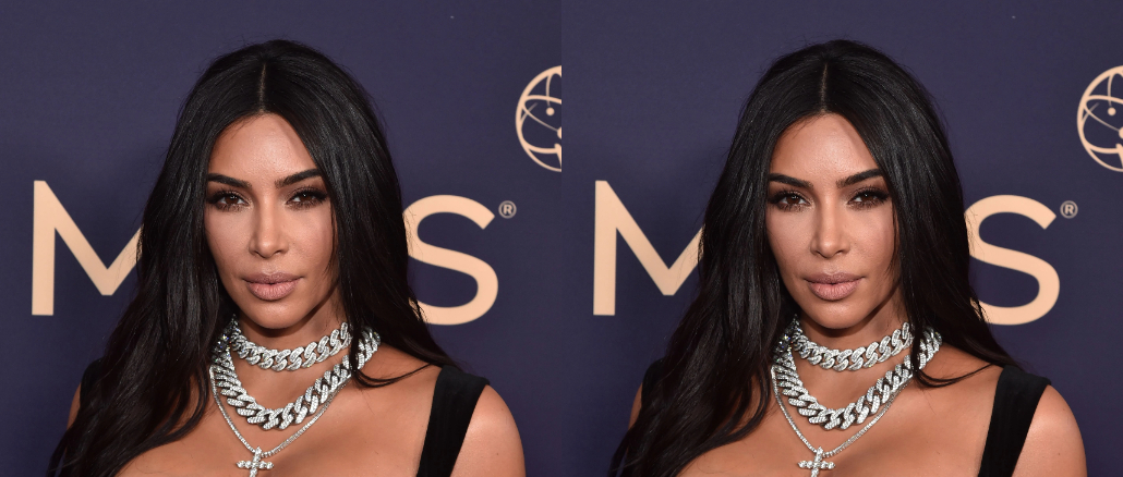 Kim Kardashian Diagnosed With Brain Problem