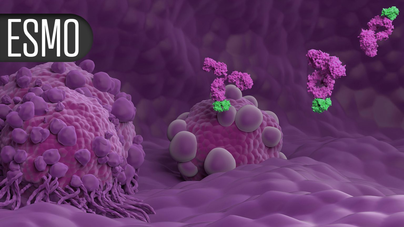 A Hit and a Miss for Liquid Biopsy to Guide Adjuvant Cancer Therapy