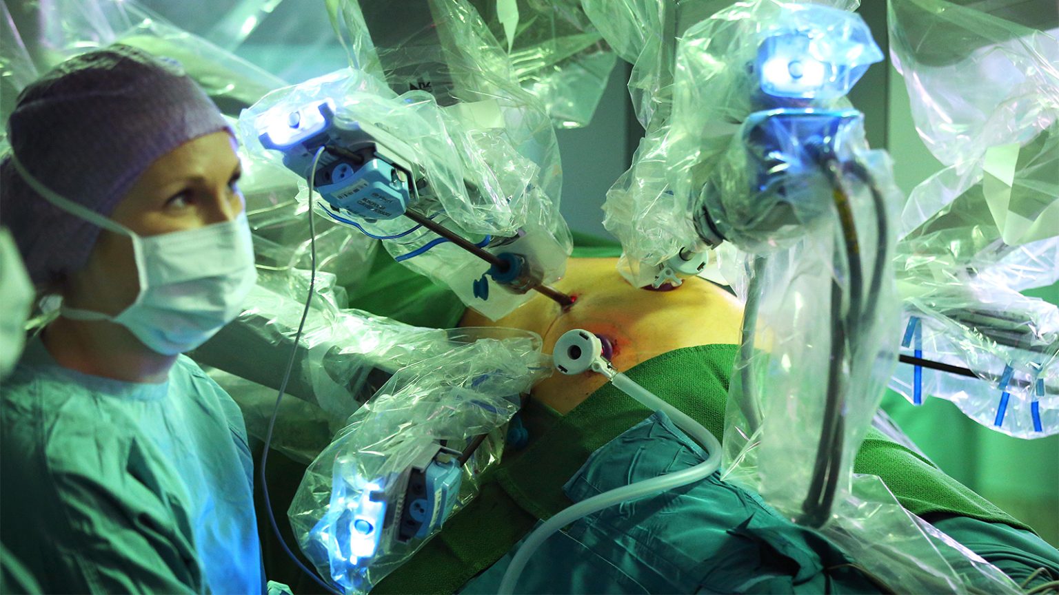 Patients With Pancreatic Cancer May Live Longer With Surgery Alone –