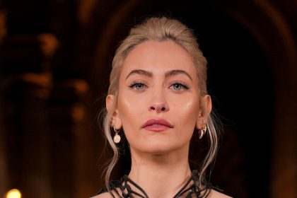 Paris Jackson reveals facial deformity after years of drug use: ‘It ruined my life’