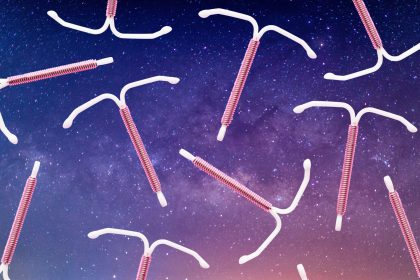 I Got Sedated for IUD Insertion Pain—Here’s What It’s Like