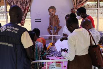 Bridging the nutrition gap: WHO and partners strengthen care for malnourished children