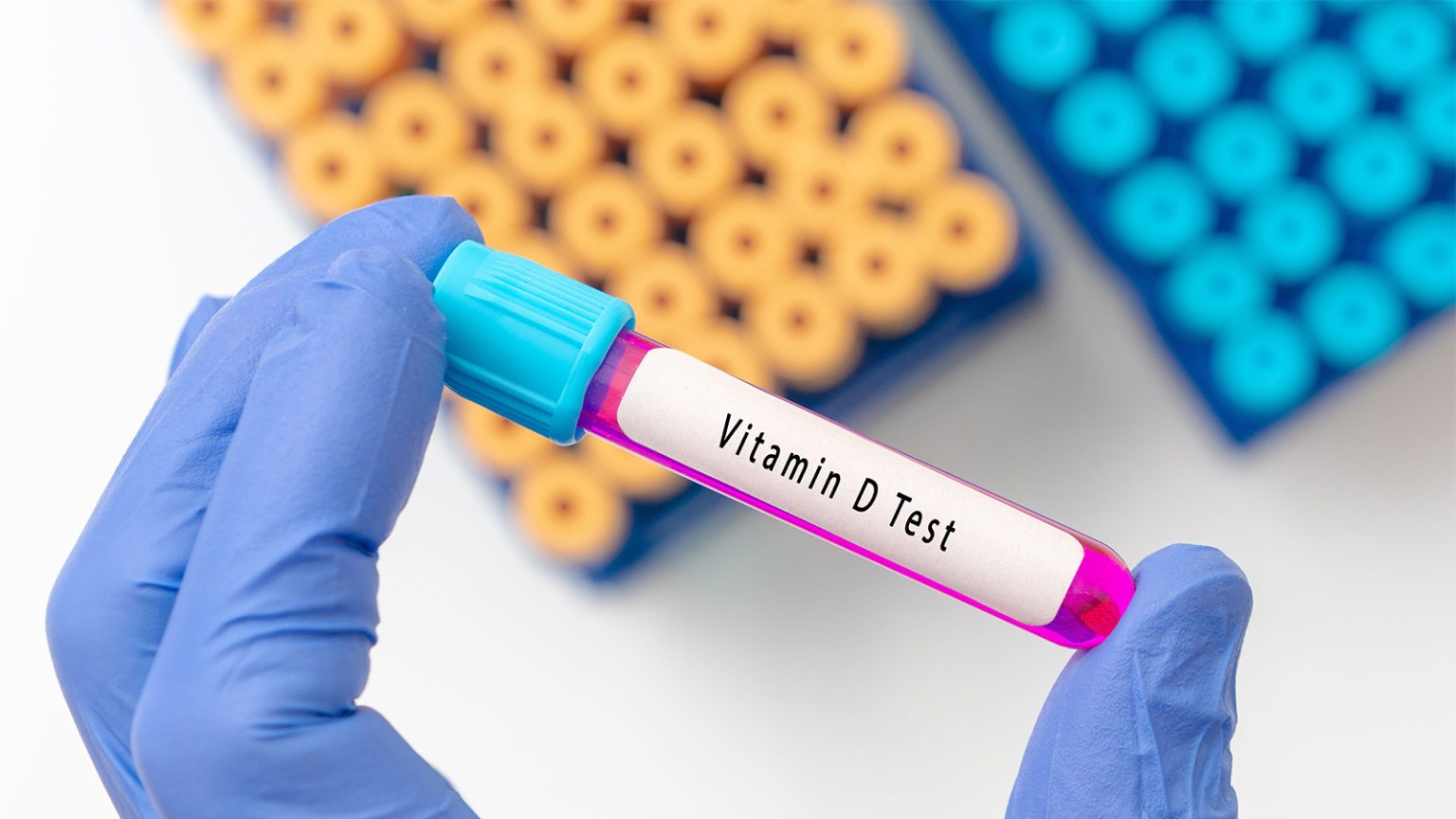 Low Vitamin D Hits Hard for Lupus Patients