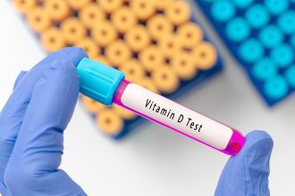 Low Vitamin D Hits Hard for Lupus Patients