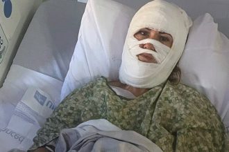 Georgia woman hospitalized after attacker hurls corrosive chemical during evening walk