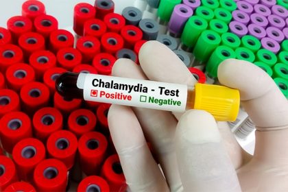 Low Rates Seen With Packaged STI Testing