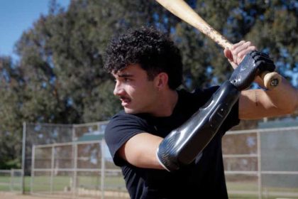 Bionic hand brings baseball star back to the field