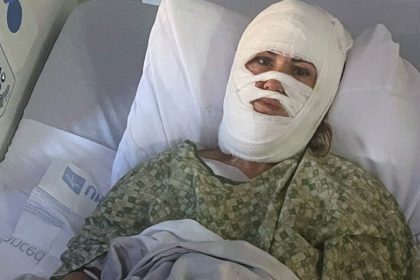 Georgia woman hospitalized after attacker hurls corrosive chemical during evening walk