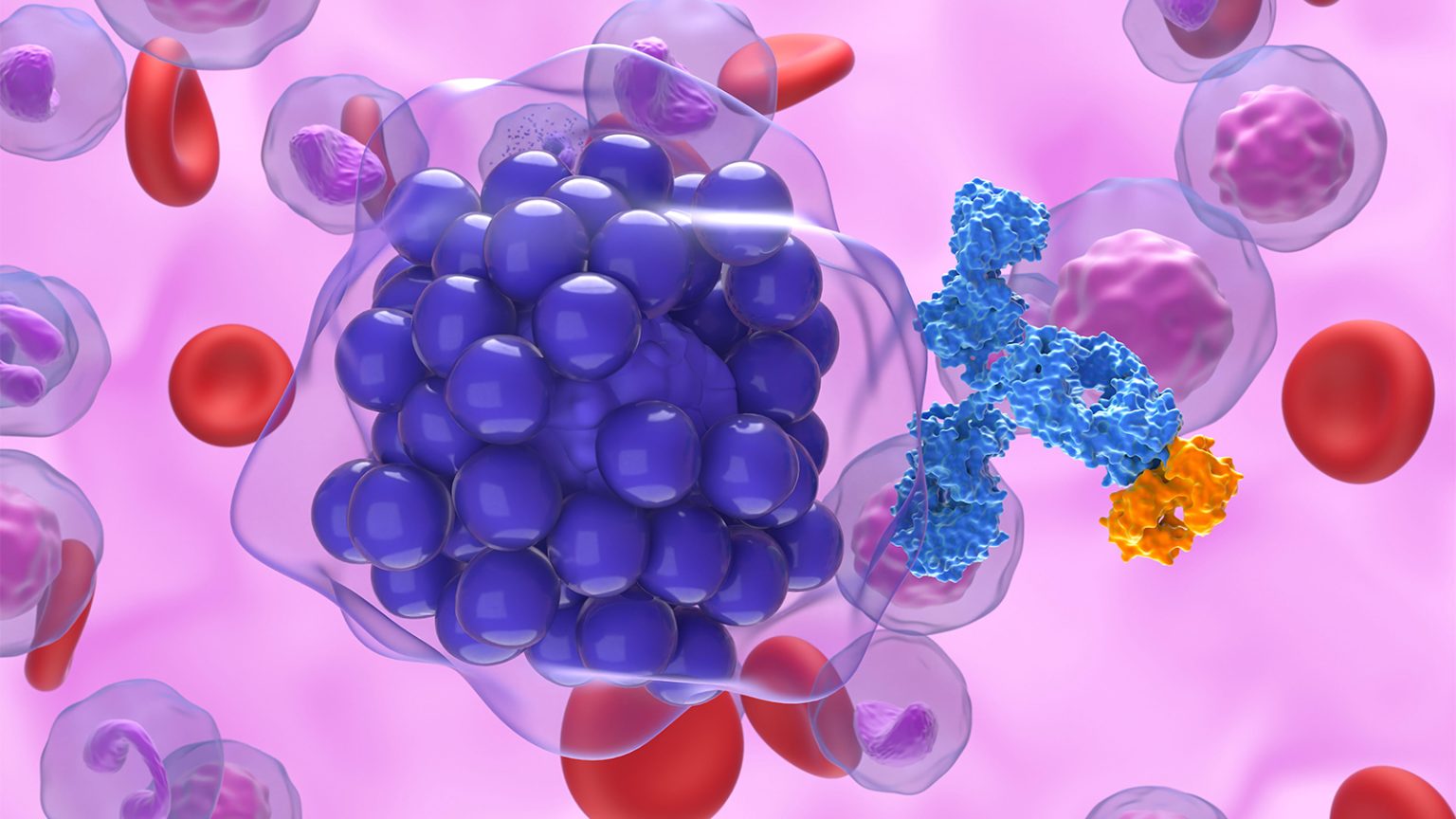Bispecifics Before CAR-T May Be Best-Bet Sequence for Large B-Cell Lymphoma