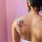 Lawless Nigerian Policemen In Delta Command Brutalise, Detain Woman For Days Over Alleged Possession Of Condom